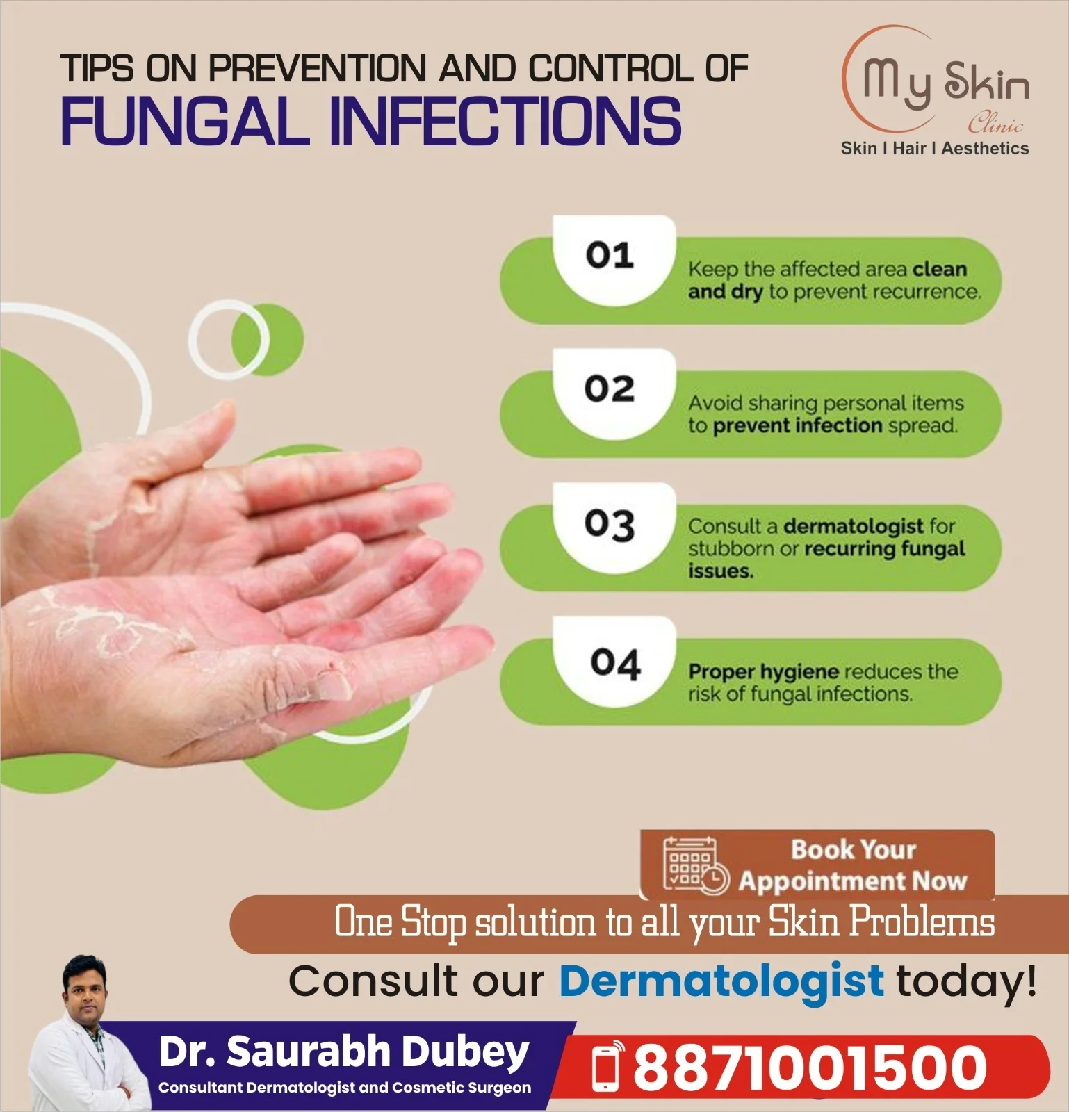Fungal Infection Treatment in Indore 